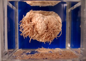 Cosa vedere a Tokyo (Giappone): il museo più strano del mondo, il Meguro Parasitorogical Museum 